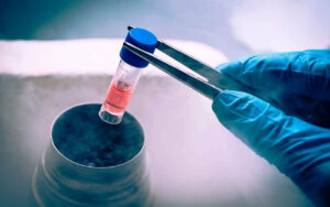 pasos congelación de esperma